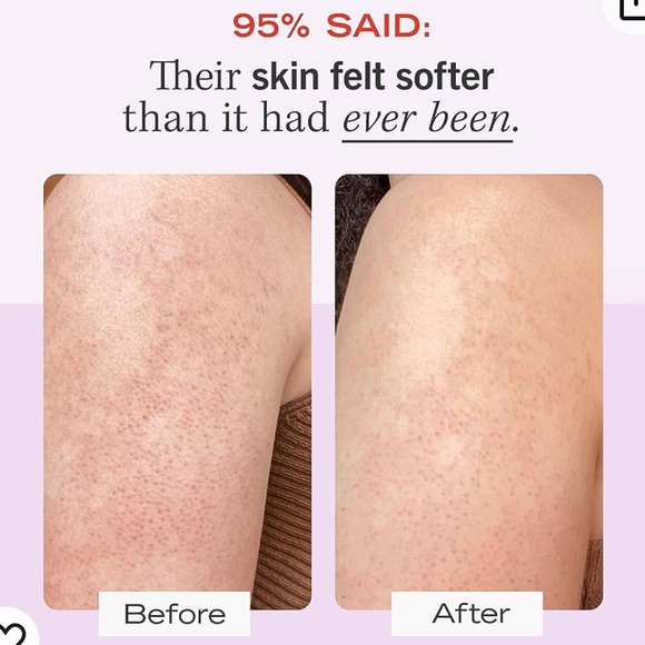 NWT First Aid Beauty KP Bump Eraser Body Scrub Exfoliant with 10% AHA – 8 oz - Picture 5 of 6